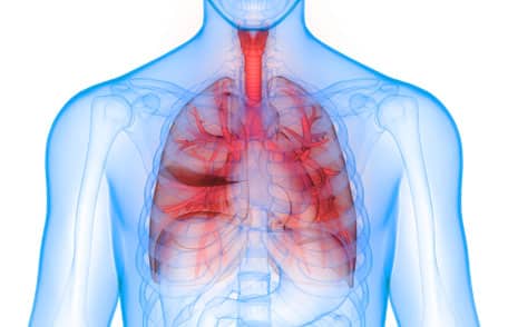 COPD lungs inflamed