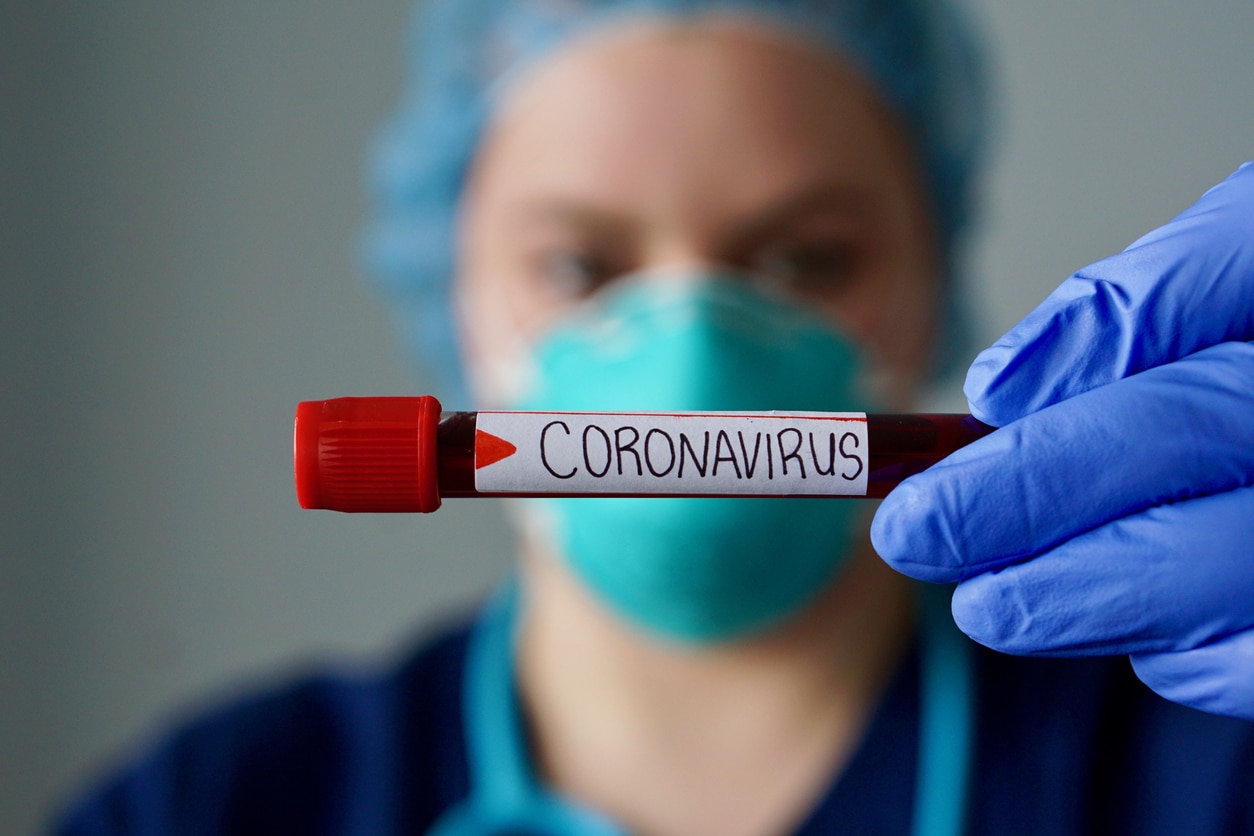 COVID-19 testing sample