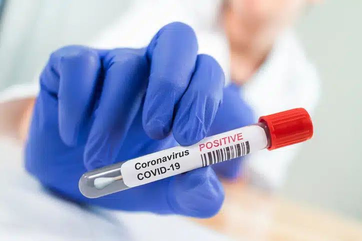 Infected Swab Test Sample in Doctor Hands. COVID-19 Epidemic and Virus Outbreak.