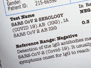 How Do I Get My COVID-19 Test Results?