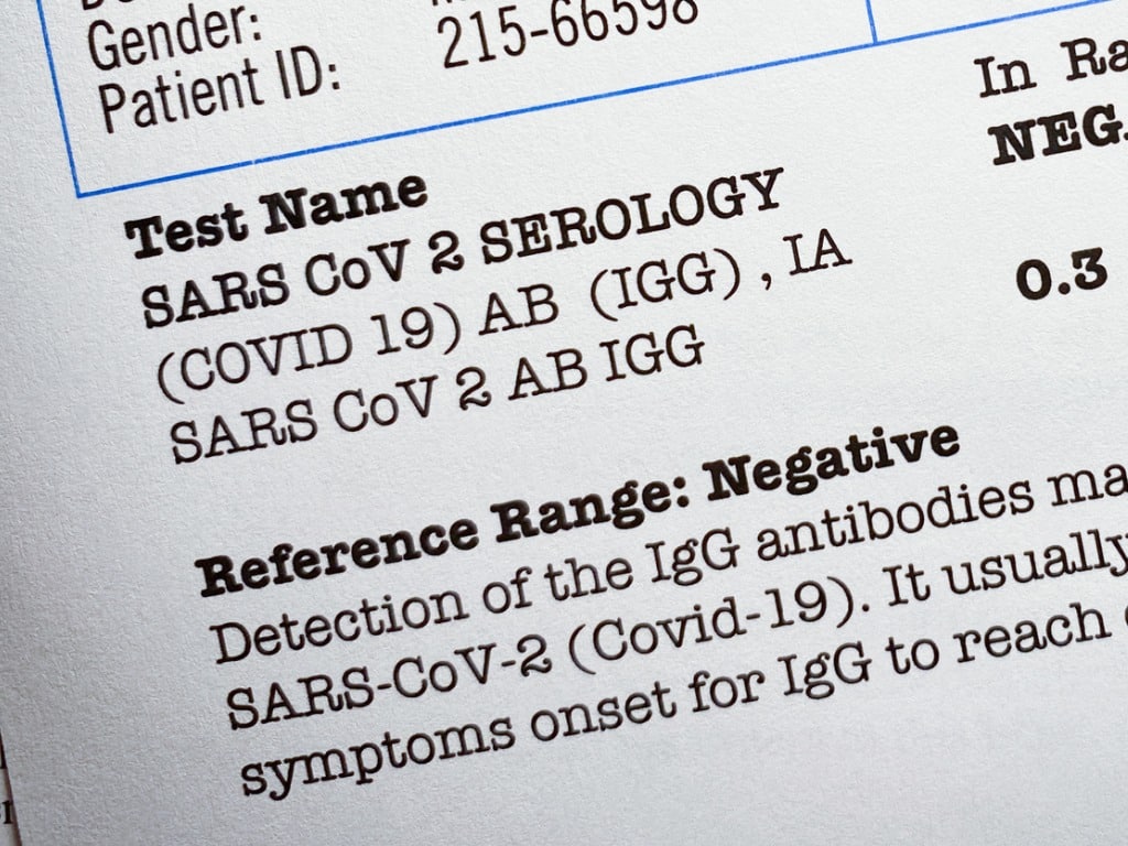 swab-results