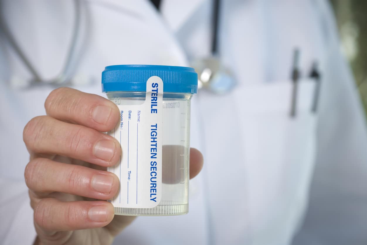 doctor holding urine lab tests kit